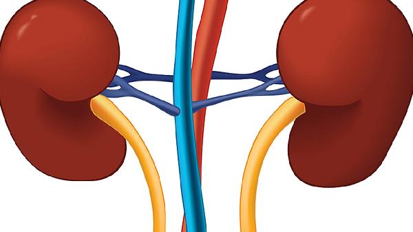 腎血管狹窄原因有哪些