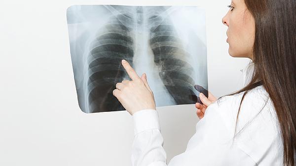 腺樣體肥大呼吸困難怎么辦