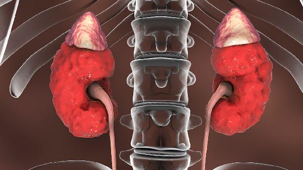 慢性腎炎和腎功能衰竭的區(qū)別