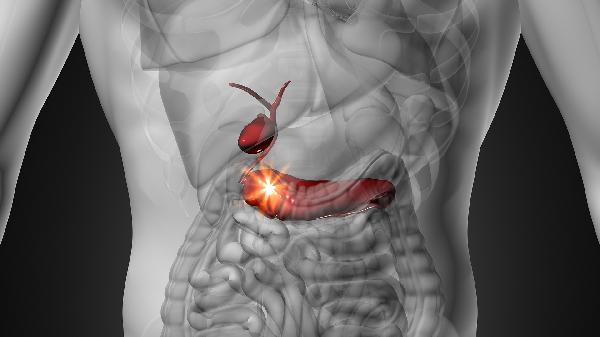 胰腺炎與胰腺癌的區(qū)別是什么