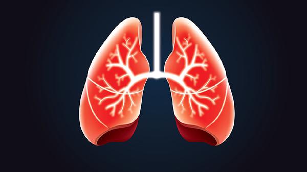 急性呼吸窘迫綜合征怎么治療