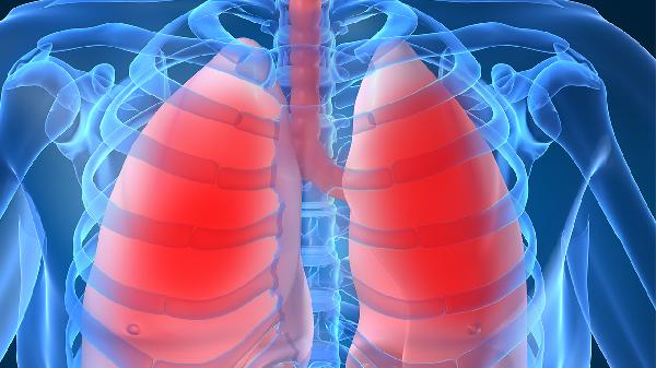 Lung-RADS3類肺結(jié)節(jié)是什么意思