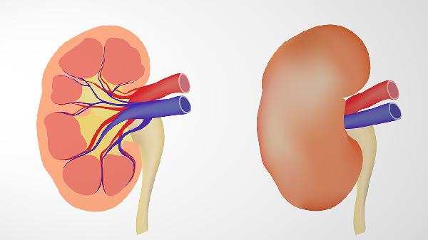 什么因素導(dǎo)致了腎囊腫的發(fā)生 腎囊腫的4個原因別大意