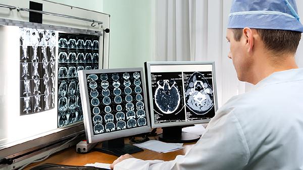 腦出血手術會花15萬嗎 腦出血手術收費標準細說