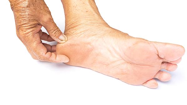 得了跟腱炎是不是没办法运动