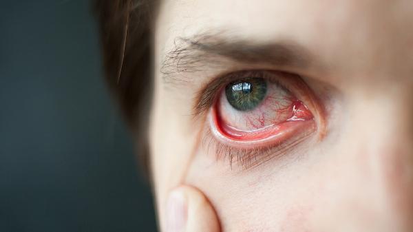 眼底有病能治好嗎 教你正確方法處理眼底病變