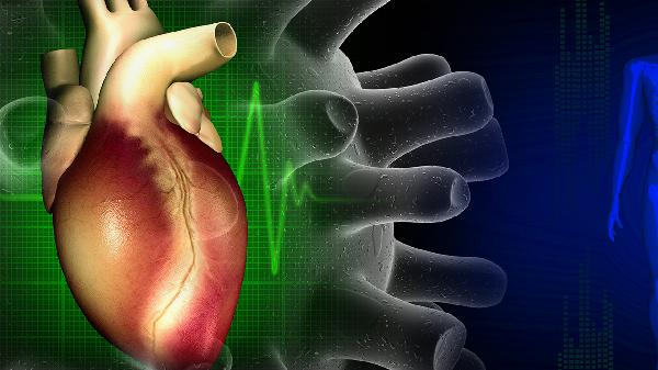 心肌梗死st段抬高是什么意思