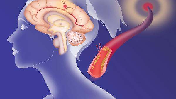 輕度缺氧缺血性腦病能自愈嗎 缺氧缺血性腦病要這樣治療