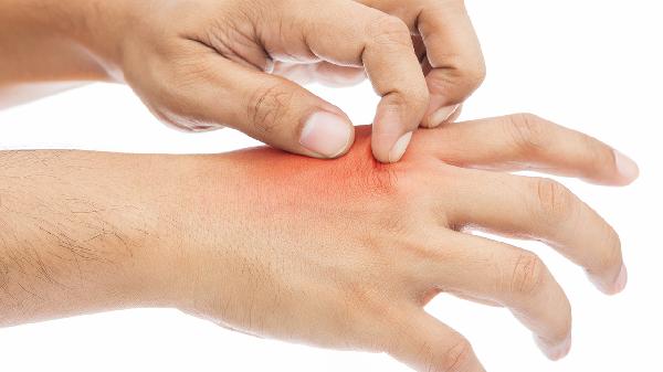 大腿內(nèi)側(cè)皮膚瘙癢紅疹是怎么回事