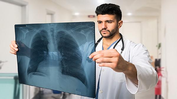 微浸潤肺腺癌生存期還有多久
