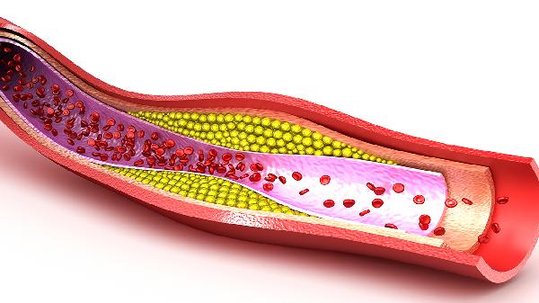 肉芽腫性血管炎是怎么回事