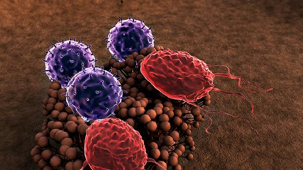 容易复发的良性肿瘤