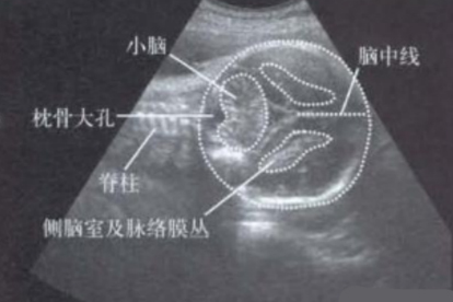 脊髓小脑变性症的治疗方法有哪些