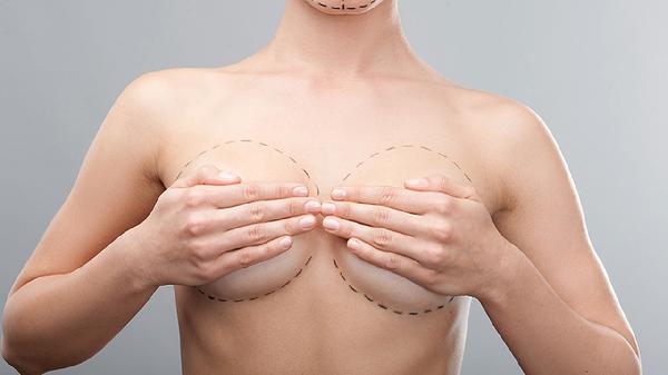 女性乳頭癢可能是乳房濕疹或乳腺癌的前兆嗎