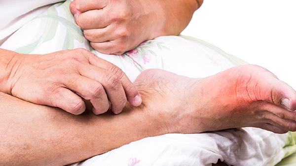 4歲寶寶腳面骨頭凸起有事嗎