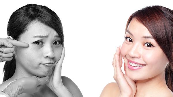 激光美容祛斑多少錢