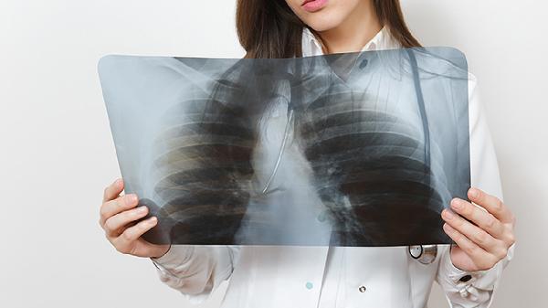 如何鉴别新生儿肺炎
