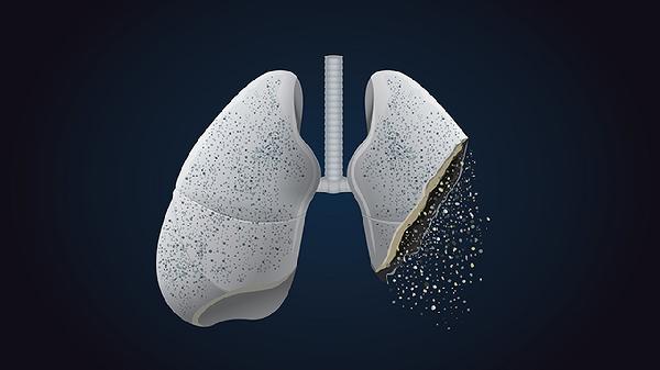 左肺舌段慢性炎症怎么治疗