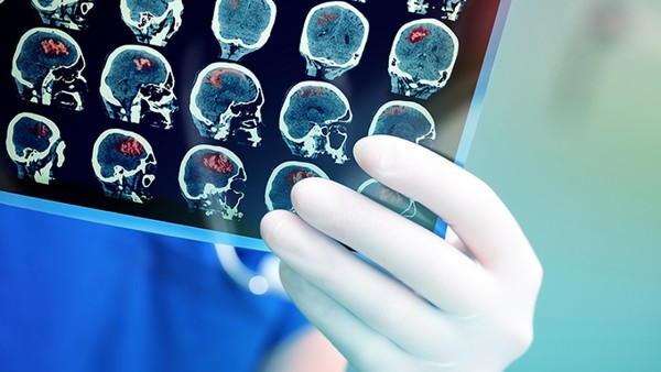 脑袋昏沉有眩晕感恶心怎么回事