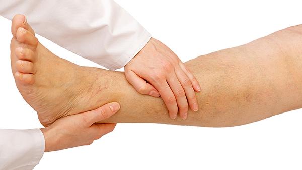 髋关节炎怎么治疗才可以彻底治好