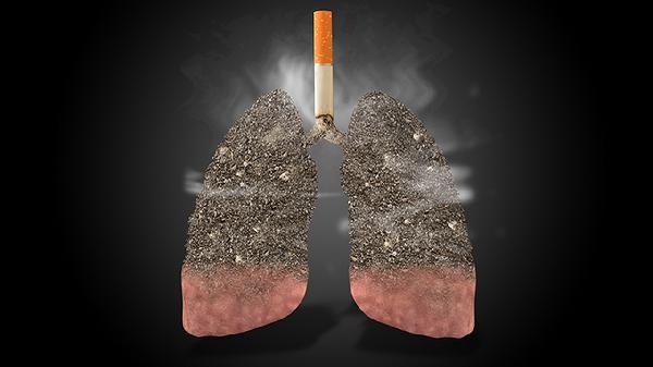 中重度阻塞性肺通气功能障碍的原因