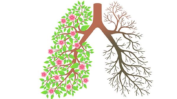 肺部结节种类及癌变几率