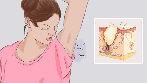 狐臭的原因及解決辦法女性