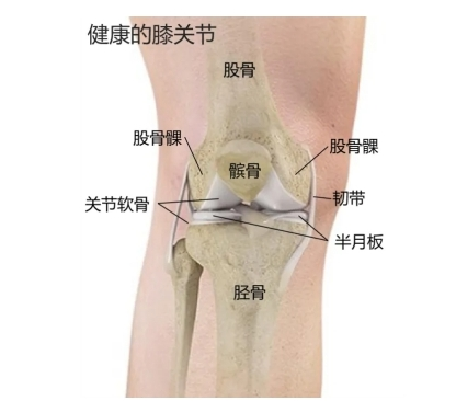 膝关节疼痛的主要原因？中老年人如何破局？