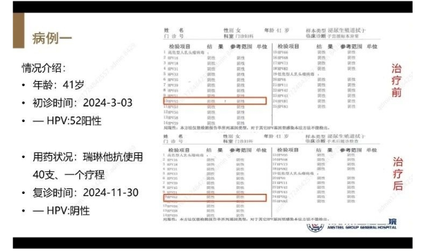 聚焦HPV防治新进展，瑞琳他抗第二十六期网络病例研讨会圆满召开