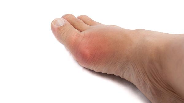 糖尿病足腳趾黑發(fā)干能治嗎