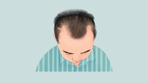 掉发发际线往后移什么原因