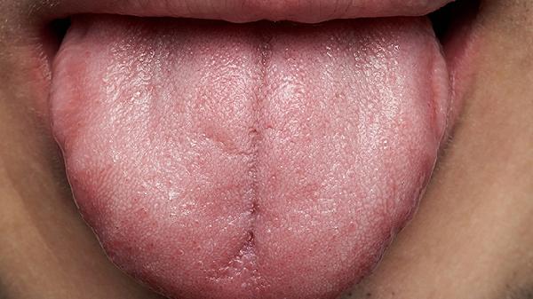 舌下腺癌術(shù)后能活多久