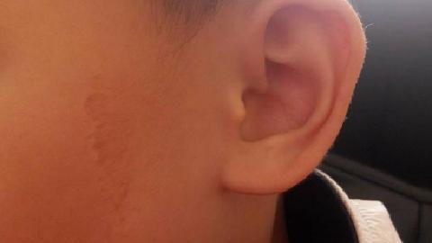耳朵和腎臟有什么關(guān)系？