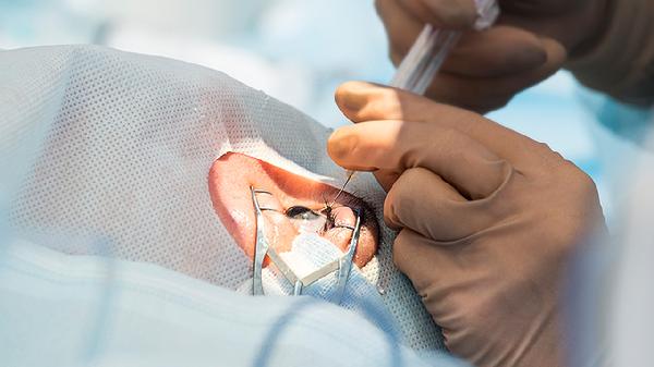 眼角腫了是怎么回事？