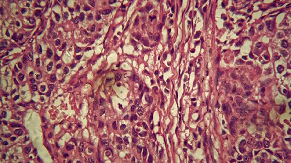 鼻病毒是腺病毒吗