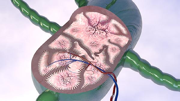 左侧颈动脉狭窄的危害有哪些