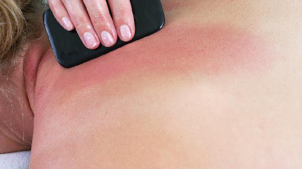 面部刮痧板有用吗