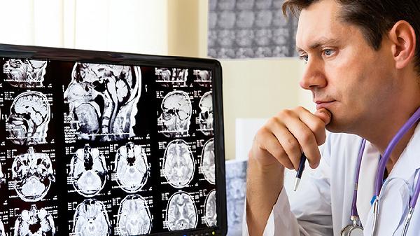 輕微腦供血不足是怎么回事