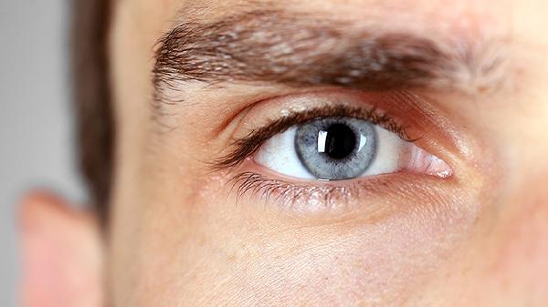 干眼癥能自我治愈嗎