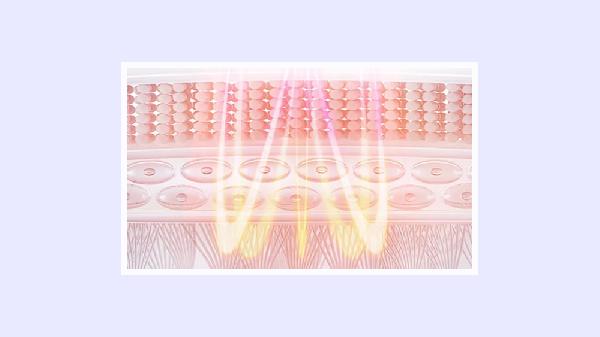 射頻吸脂引起副作用