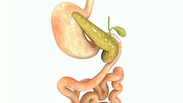 如何有效解決高膽固醇