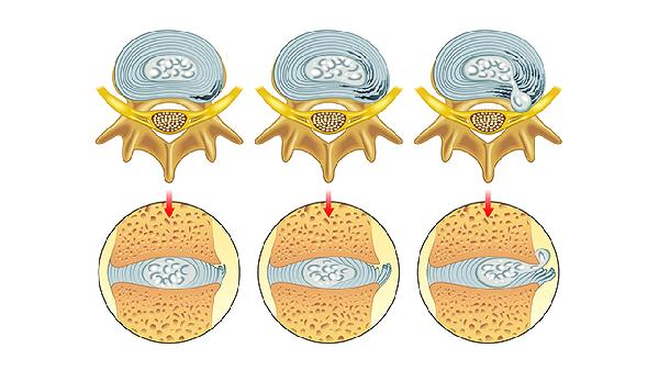 20歲眼霜推薦眼霜入門(mén)寶典