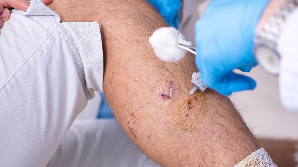 注射羊胎素會(huì )帶來(lái)副作用嗎