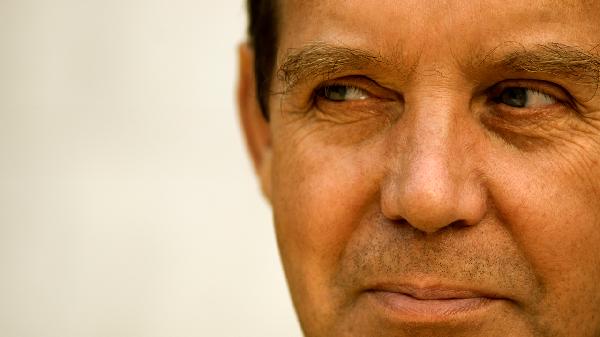 毛發(fā)栽培技術(shù)中的眉毛栽培好嗎