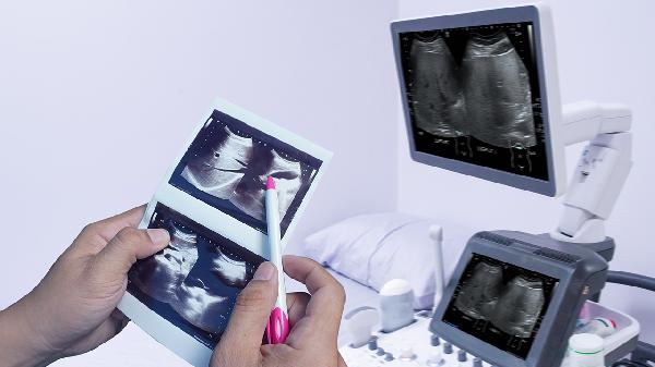 哪次超聲波檢查需要時間