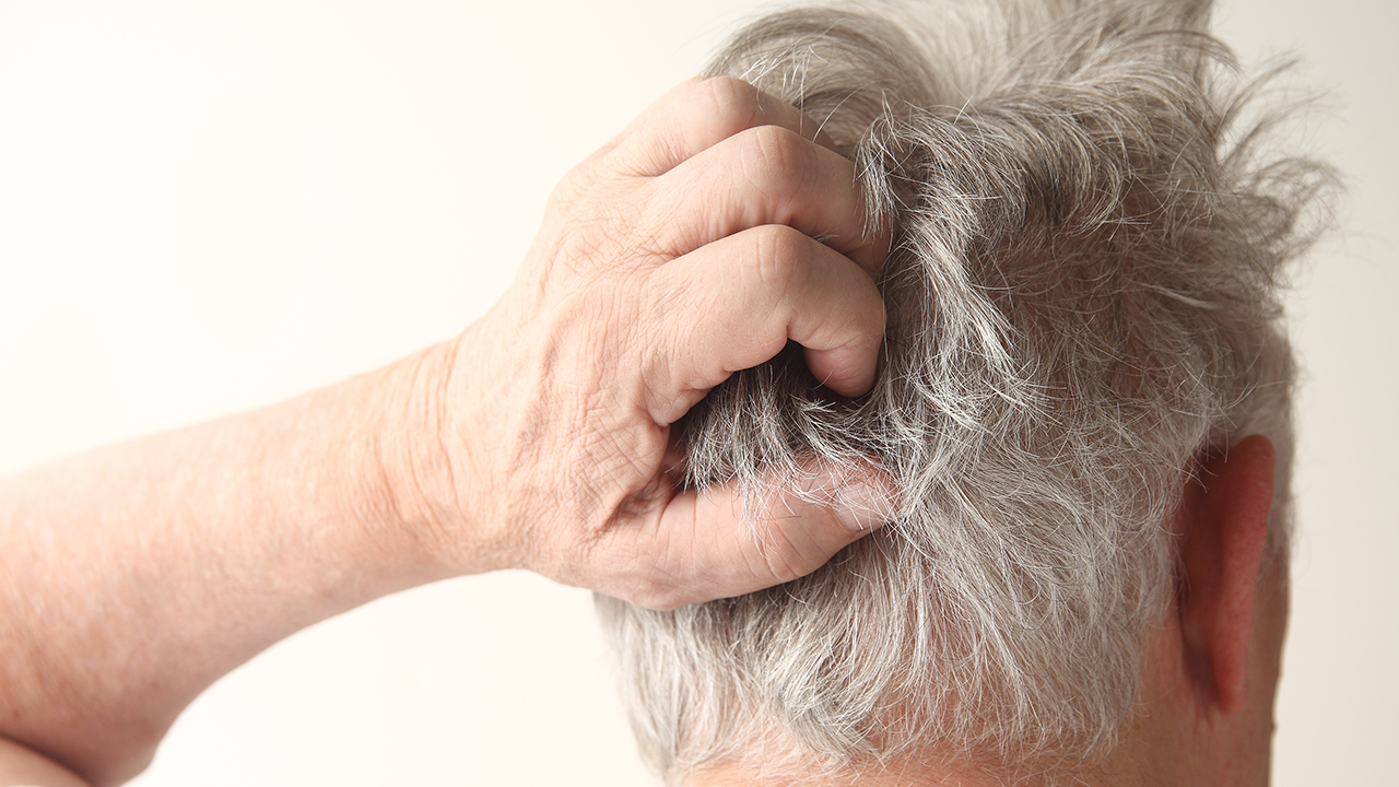 脂溢性脱发还能恢复过来吗