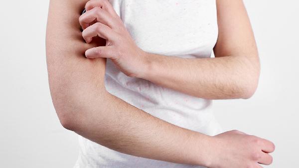 女性過(guò)敏性皮炎應該怎么護理