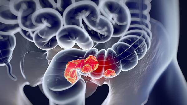 孩子16歲骨骼基本閉合還能再長(zhǎng)嗎