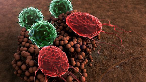 髖臼囊腫會(huì )導致股骨頭壞死嗎