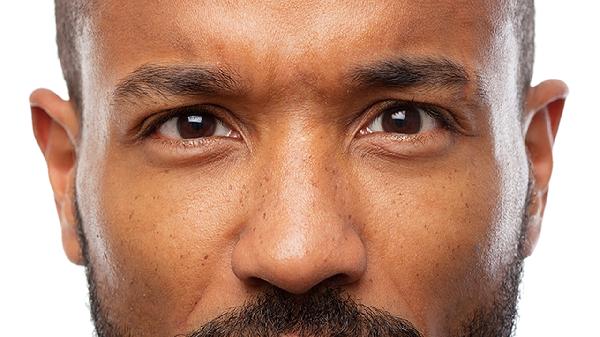 眼部線雕有何副作用